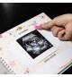 Kişiye Özel 10 Fotoğraflı Hamilelik Ve Anne Bebek Günlüğü - Anı Defteri Baby Shower Bebek Hediyesi